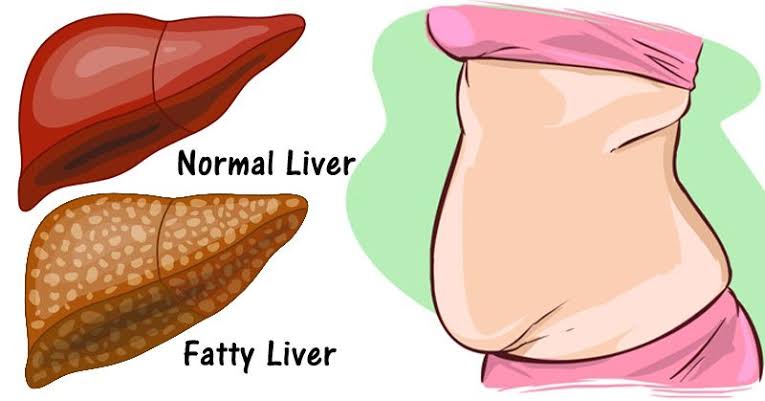 www.spiiritselfhealth.com-liver is full of toxins