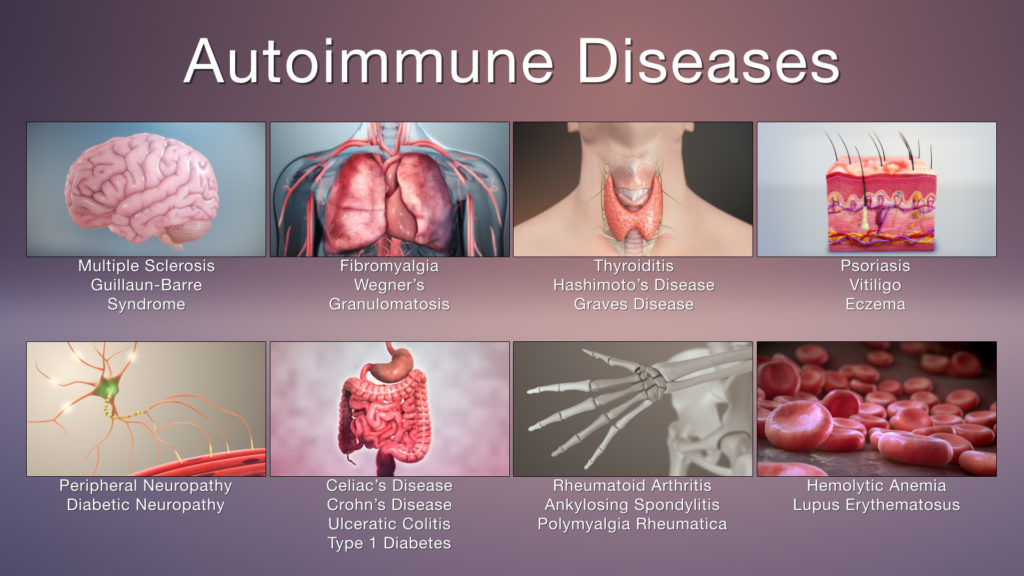 www.spiritselfhealth.com-autoimmune-disease