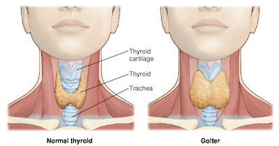 www.spiritselhelp.com-symptoms of hypthyroidism