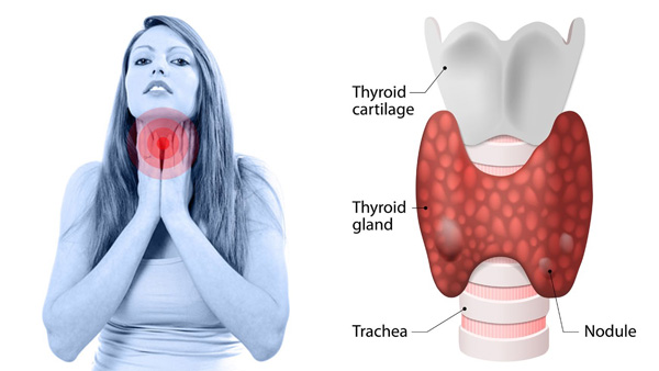 www.spiritselhelp.com-symptoms of hypothyroidism
